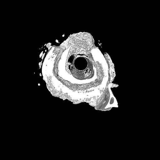 Transverse micro-CT image of an infected rabbit tibia