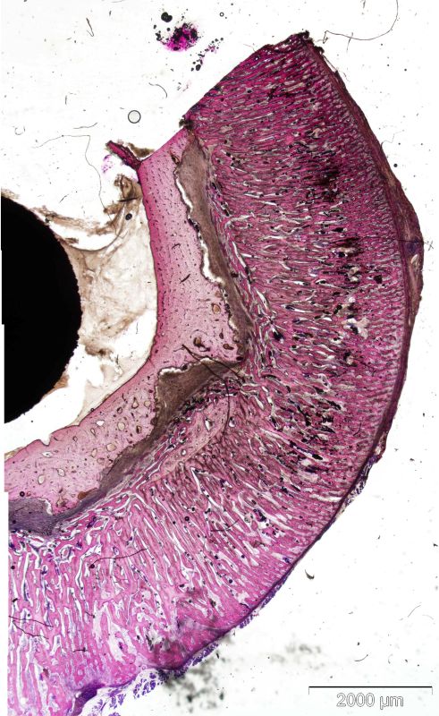Histological overview of reactive bone formation