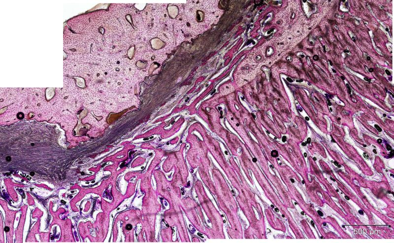 Higher magnification view of the original cortex and adjacent newly formed bone